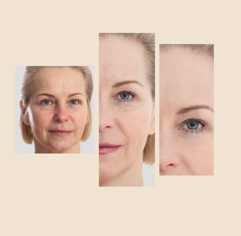 The Eraser Spot Cream | Dark Spot Corrector